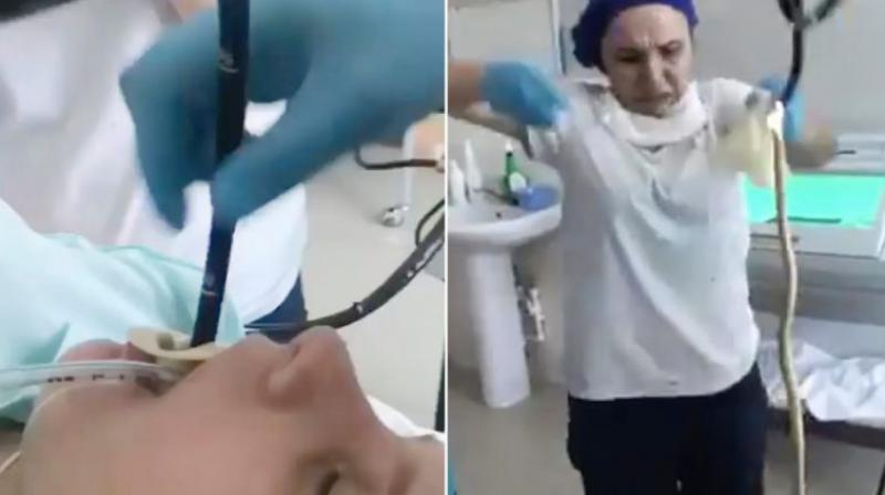 Doctors Pull 4-Feet Snake Out of Woman’s Mouth in Russia Doctors Pull 4-Feet Snake Out of Woman’s Mouth in Russia