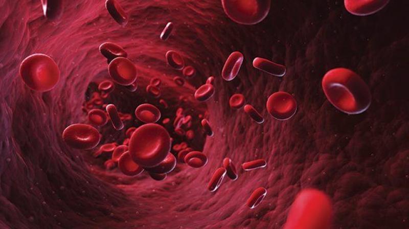 anemia anemia