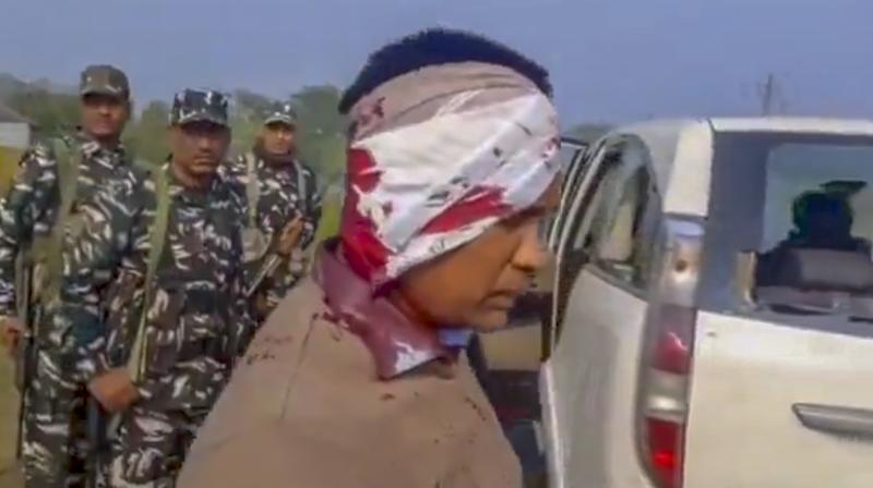 North 24 Parganas: An Enforcement Directorate (ED) official after getting assaulted allegedly by the supporters of TMC leader Sheikh Sajahan during a raid at the latter’s residence, in North 24 Parganas district, Friday, Jan. 5, 2024. ED officers were on Friday assaulted and their vehicles were damaged allegedly by the supporters of Sajahan when they tried to raid his residence in connection with their probe into the ration distribution scam. (PTI Photo) North 24 Parganas: An Enforcement Directorate (ED) official after getting assaulted allegedly by the supporters of TMC leader Sheikh Sajahan during a raid at the latter’s residence, in North 24 Parganas district, Friday, Jan. 5, 2024. ED officers were on Friday assaulted and their vehicles were damaged allegedly by the supporters of Sajahan when they tried to raid his residence in connection with their probe into the ration distribution scam. (PTI Photo)