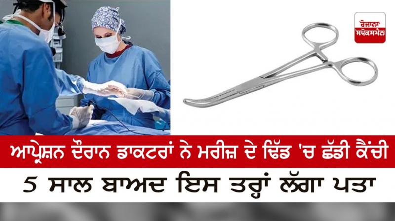 Scissors left by the doctors in the patient's stomach during the operation Scissors left by the doctors in the patient's stomach during the operation