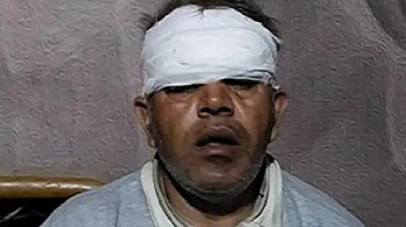 China Door accident in Ludhiana: Activa rider's fingers and forehead fell on the road, 56 stitches needed China Door accident in Ludhiana: Activa rider's fingers and forehead fell on the road, 56 stitches needed