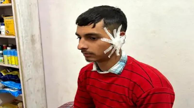 The teacher slapped and tore the eardrum of the student Haryana News in punjabi The teacher slapped and tore the eardrum of the student Haryana News in punjabi