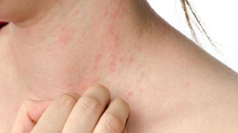 Try these recipes to get rid of bile problem in summer Health News Try these recipes to get rid of bile problem in summer Health News