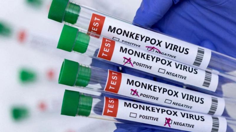Monkeypox Monkeypox
