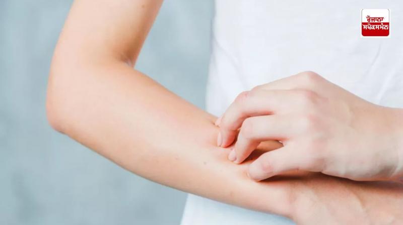 Follow these home remedies to protect your hands from dryness in winter Follow these home remedies to protect your hands from dryness in winter