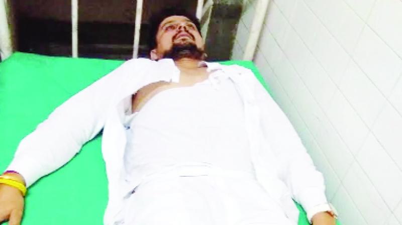 During Treatment Harman Badla During Treatment Harman Badla