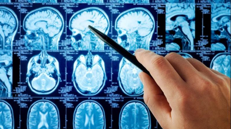 brain tumors brain tumors