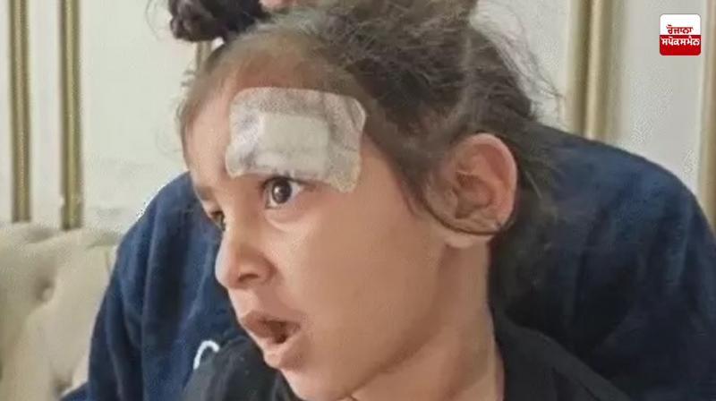 Doctor's feat in Meerut, instead of stitching a two and a half year old child's wound, applied fevicik