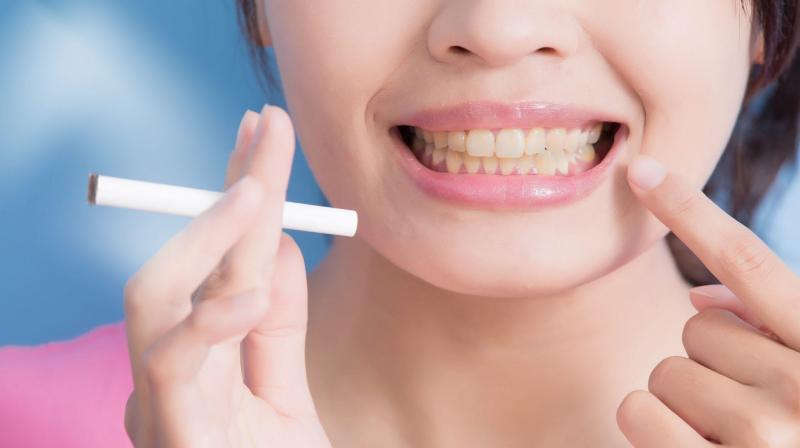 Follow these home remedies to get rid of yellow teeth Follow these home remedies to get rid of yellow teeth