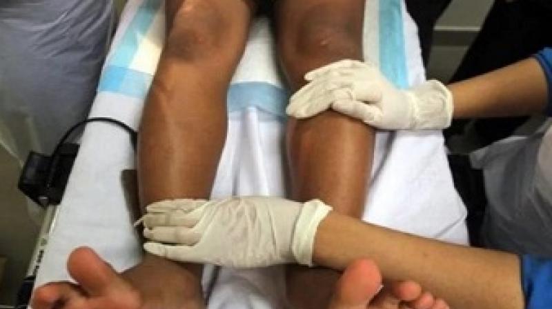 Writ petition to ban female genital mutilation filled before Supreme Court Writ petition to ban female genital mutilation filled before Supreme Court