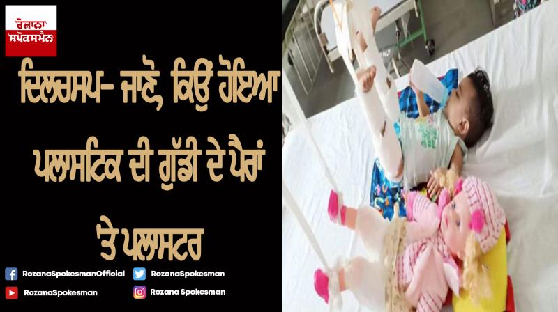 to fix 11 month olds fracture doctors first had to plaster her doll to fix 11 month olds fracture doctors first had to plaster her doll