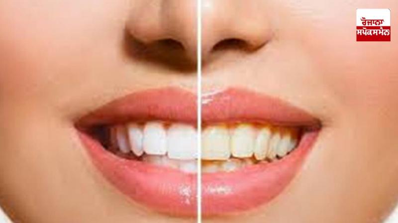 If you want to get rid of yellowness of teeth then follow this recipe If you want to get rid of yellowness of teeth then follow this recipe