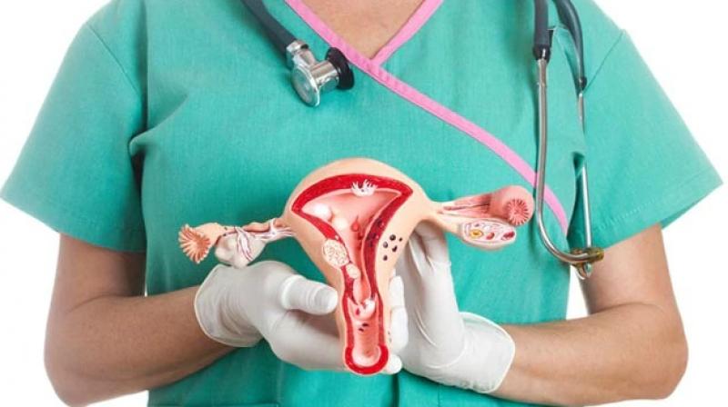Cervical Cancer Cervical Cancer