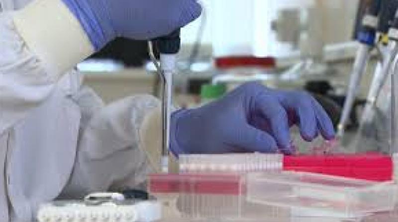 good news for TB patients new technology good news for TB patients new technology