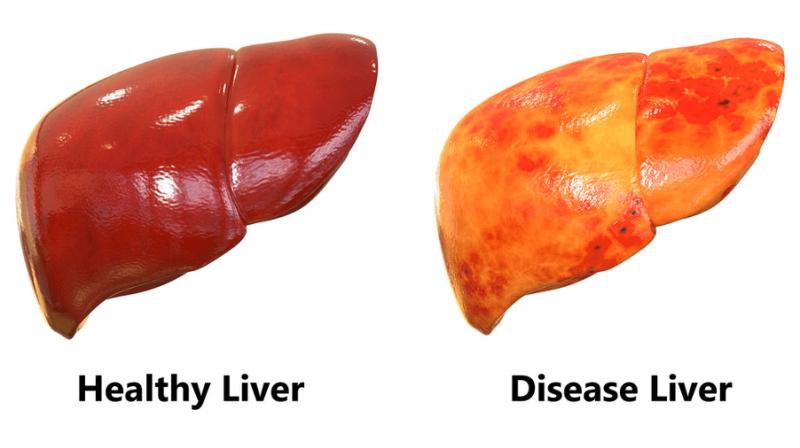 Liver Liver