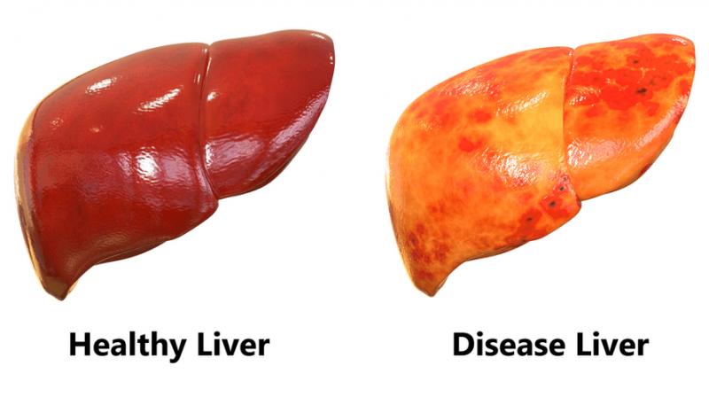 Liver