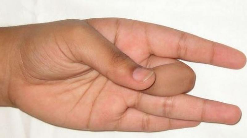 Hand Exercises Hand Exercises