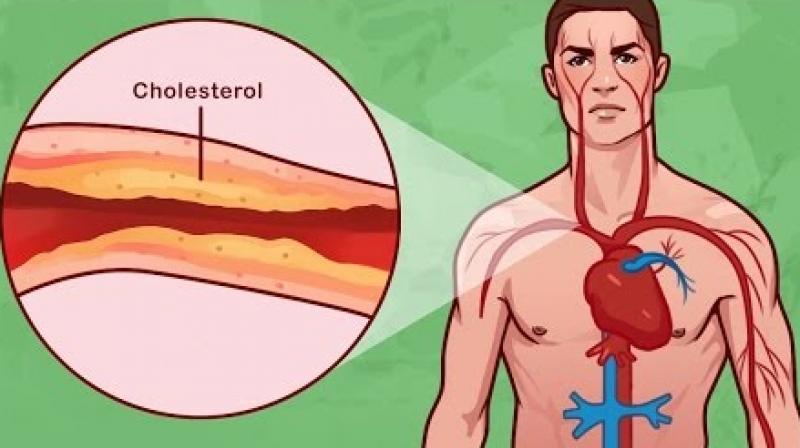 Cholesterol Problem 