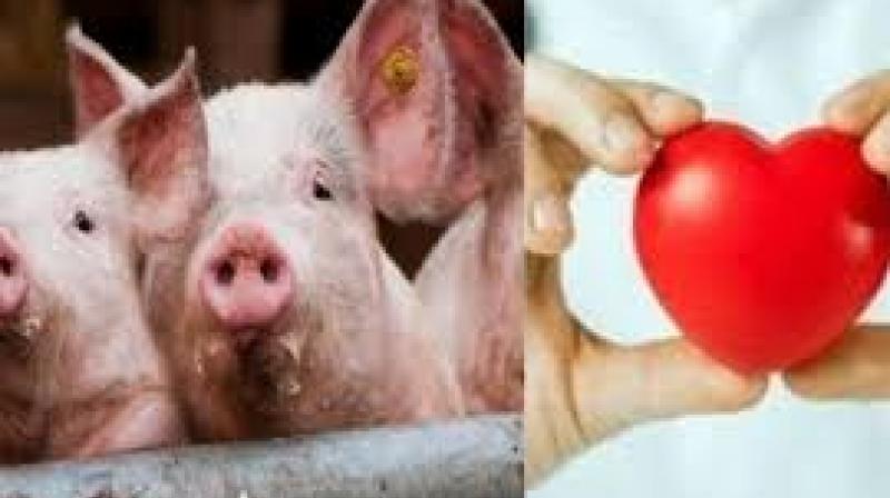 Pig hearts transplant human Sir Terence English