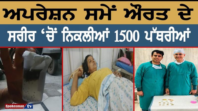 At the time of the operation, 1,500 stones exited the woman's body At the time of the operation, 1,500 stones exited the woman's body