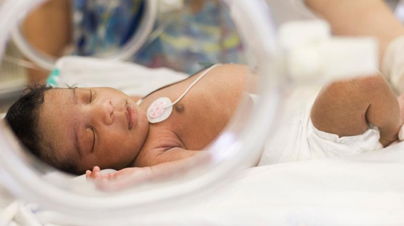 Caesarean delivery Caesarean delivery