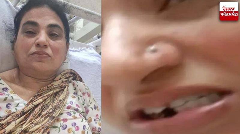 Attack on woman in nakodar Attack on woman in nakodar