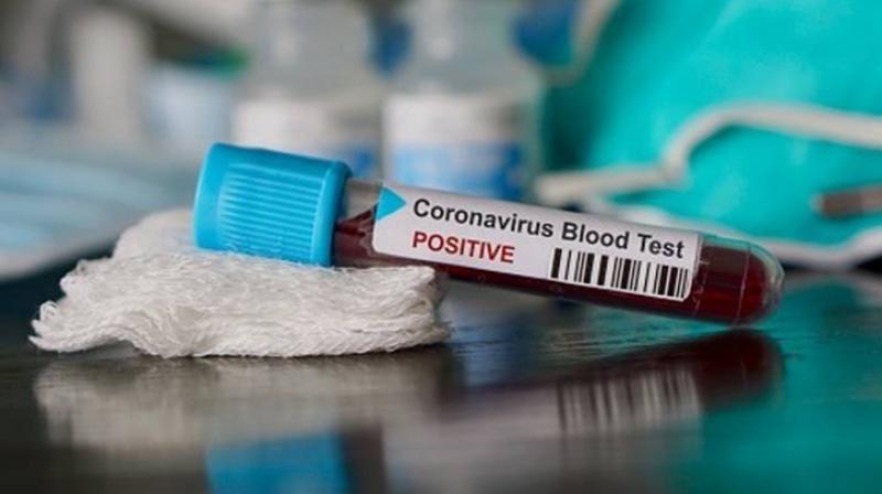 Isn't the official noise of 'the situation is like before the epidemic' misleading?