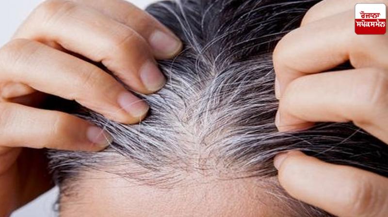 If your hair is starting to turn gray at a young age, then follow these home remedies Health News If your hair is starting to turn gray at a young age, then follow these home remedies Health News