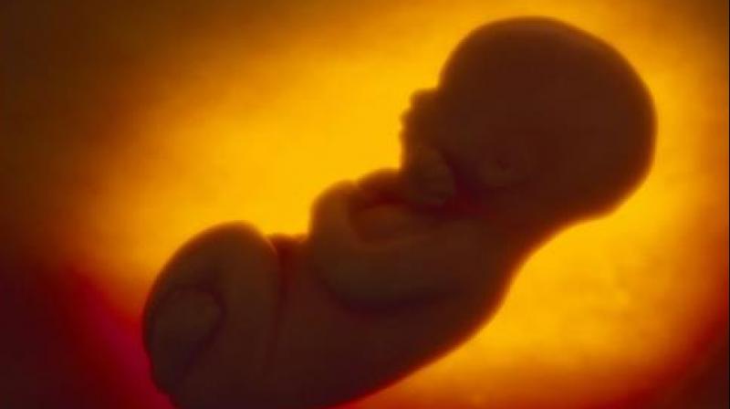 Embarrassment of humanity - Fetus recovered from the toilet Embarrassment of humanity - Fetus recovered from the toilet