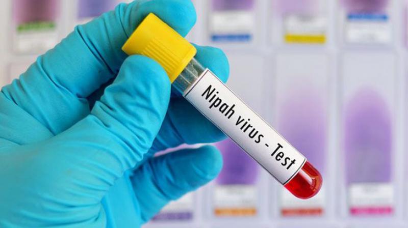 Nipah virus test