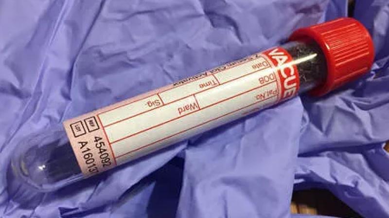 Corona Virus Corona Virus