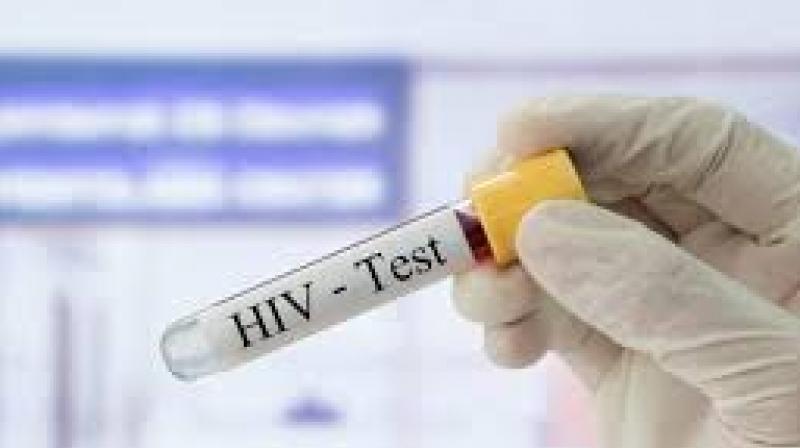HIV Test HIV Test