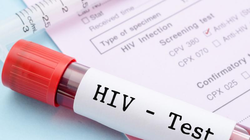 HIV HIV