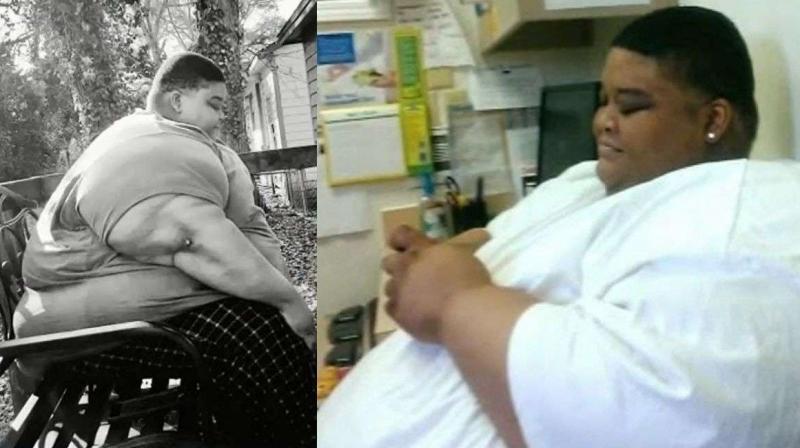 300 kg Nicholas lost 165 kg in 4 years, doctors said he was a ticking time bomb 300 kg Nicholas lost 165 kg in 4 years, doctors said he was a ticking time bomb