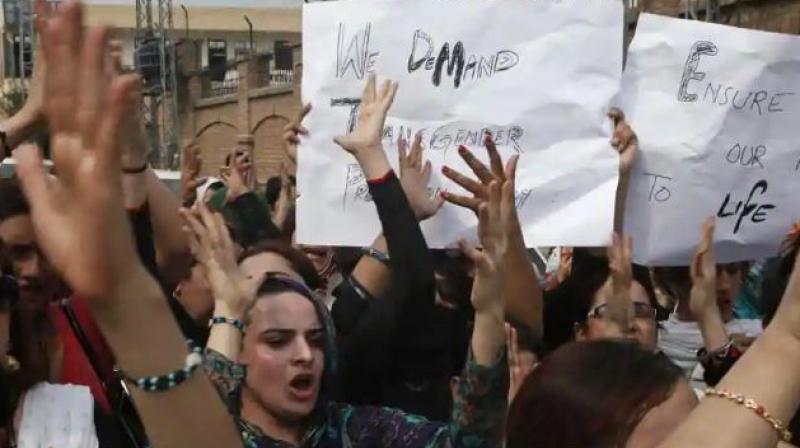 Transgender in Pakistan set on fire