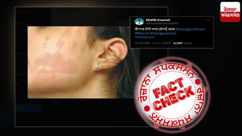 Old image from Baygon Slap advertisement viral as Kangana Face Slap marked by CISF Officer Old image from Baygon Slap advertisement viral as Kangana Face Slap marked by CISF Officer