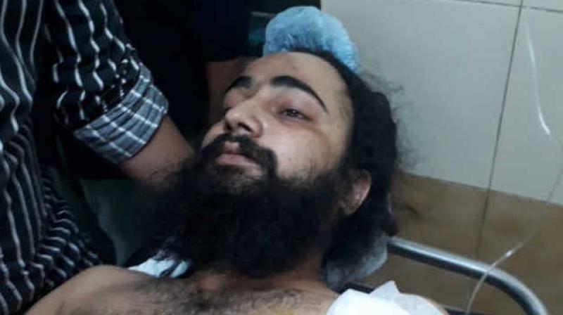 Patiala youth tries to rescue girl, shot at Patiala youth tries to rescue girl, shot at