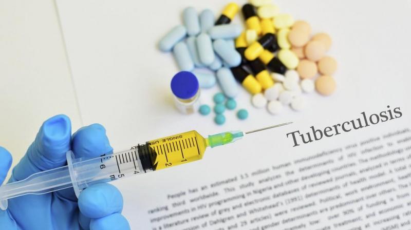 The discovery of new technology for TB treatment The discovery of new technology for TB treatment