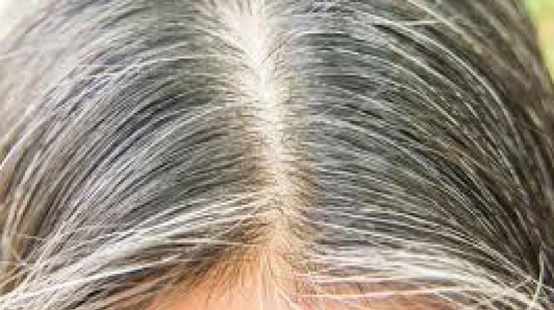 White Hair White Hair