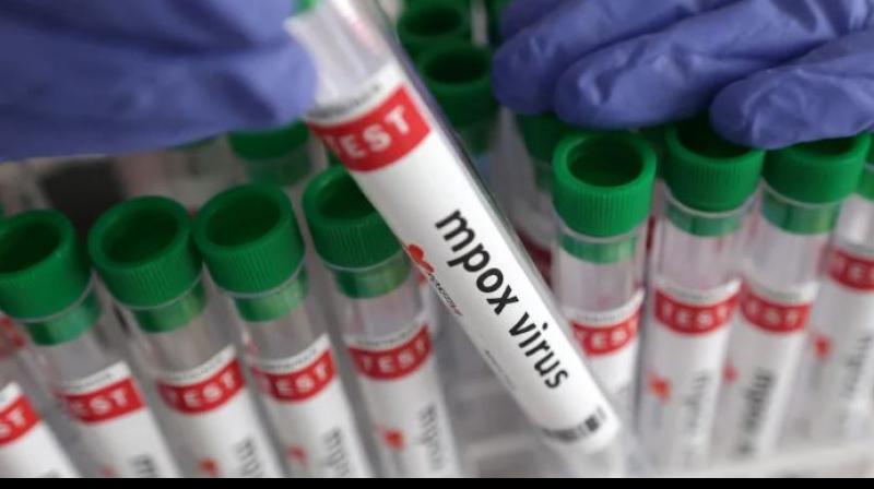 Mpox patient Mpox patient