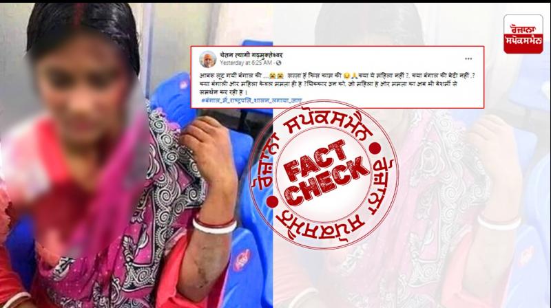 Photo of woman injured in Bangladesh linked to Bengal violence Photo of woman injured in Bangladesh linked to Bengal violence