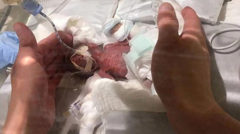 Small Baby Boy in Japan Hospital Small Baby Boy in Japan Hospital