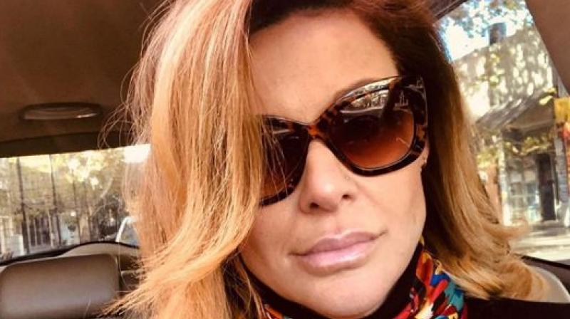 Actress-beauty queen Jacqueline Carrieri dies at 48 due to plastic surgery Actress-beauty queen Jacqueline Carrieri dies at 48 due to plastic surgery