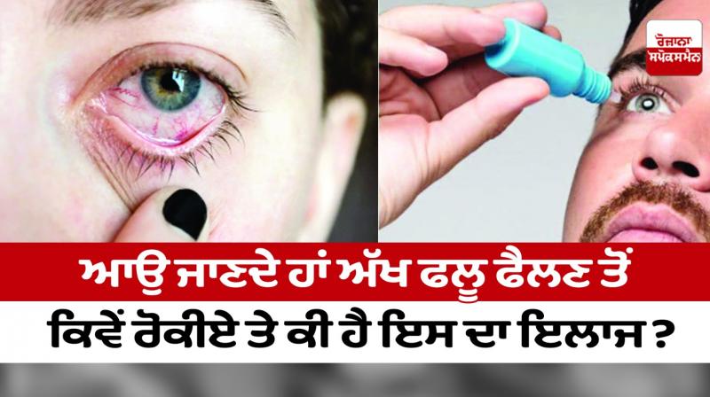 How to prevent the spread of eye flu How to prevent the spread of eye flu