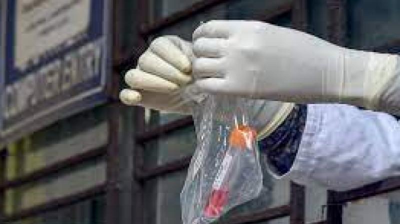 Wuhan Scientists Warn of New Coronavirus 'NeoCov' With High Death, Infection Rate Wuhan Scientists Warn of New Coronavirus 'NeoCov' With High Death, Infection Rate