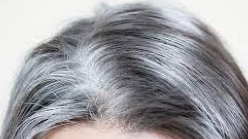 White Hair White Hair