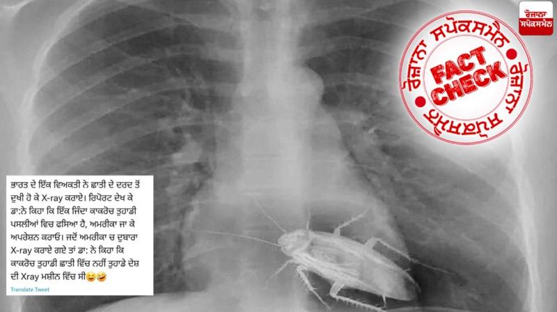 Fact Check Moprhed image of Xray viral with fake claim
