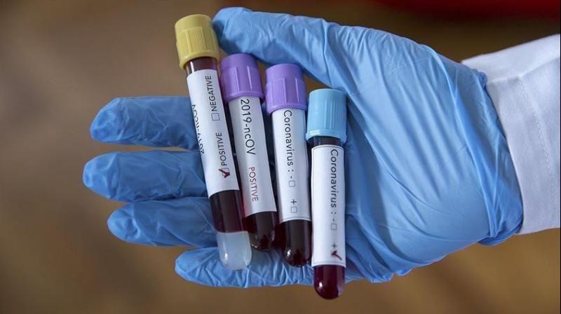 Coronavirus Coronavirus