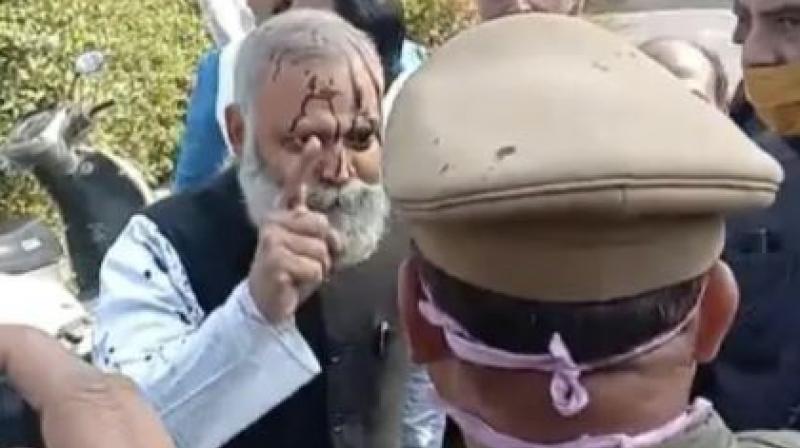 Ink thrown at AAP MLA Ink thrown at AAP MLA