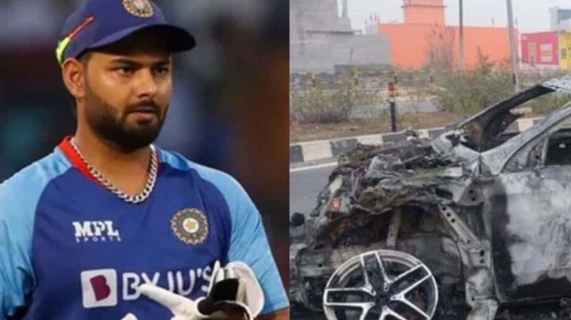 Rishabh Pant Accident: Rishabh Pant's knee surgery! Rishabh Pant Accident: Rishabh Pant's knee surgery!